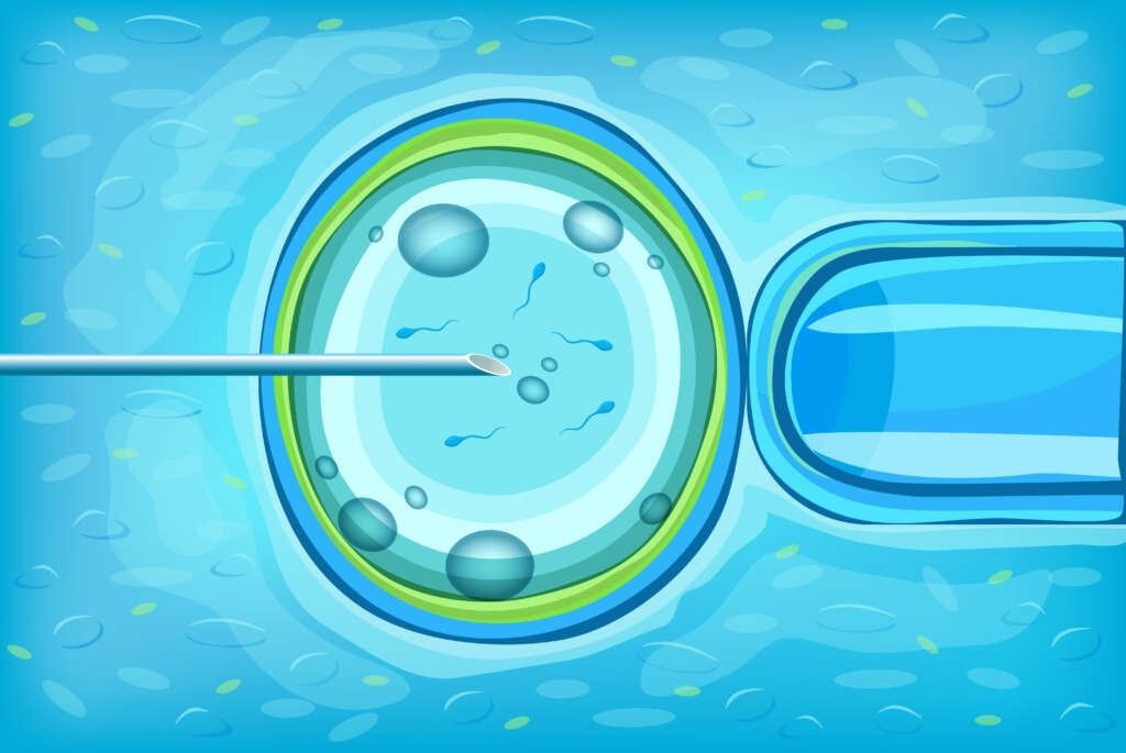 Cryopreservation Sperm and Embryo Freezing